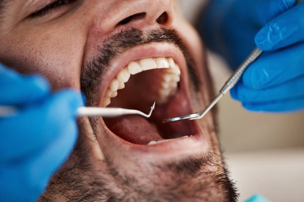 Best Broken Tooth Emergency  in Cleveland, MS