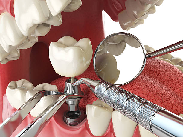 Dentist for Dental Trauma in MS